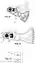 Fig. 04 - Method for assembling a motor vehicle heating, ventilation and/or air conditioning device