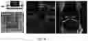 Fig. 14 - Hybrid additive-subtractive laser fabrication platform for shaping hydrogels