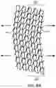 Fig. 11 - Apparel printing system and methods for printing on articles with repeating patterns
