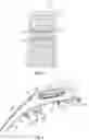 Fig. 03 - Vehicle front end tie down assemblies
