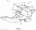 Fig. 03 - Joint for mounting an elongate element to a structural element in a vehicle
