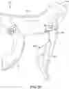 Fig. 21 - Operating device
