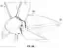 Fig. 10 - Aircraft drag reduction system including an internally cooled motor system and aircraft using same