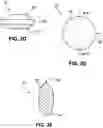 Fig. 05 - Air assisted hopper system for pellet-shaped articles