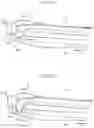 Fig. 12 - Medium ejecting apparatus including stopper to rise in response to operation of tray