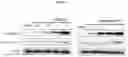 Fig. 10 - HALOGENATED PHENYLSULFONAMIDE HYDROXAMIC ACID COMPOUNDS, COMPOSITIONS AND USES THEREOF AS SELECTIVE HDAC6 INHIBITORS