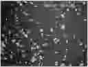 Fig. 01 - Plinabulin compositions