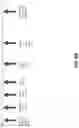 Fig. 19 - METHODS OF TREATING NEUROCOGNITIVE DISORDERS, CHRONIC PAIN AND REDUCING INFLAMMATION