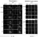 Fig. 09 - COMPOUNDS FOR TARGETED THERAPIES OF CASTRATION RESISTANT PROSTATE CANCER