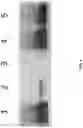 Fig. 05 - Msp nanopores and uses thereof