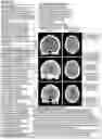 Fig. 136 - CHIMERIC ANTIGEN RECEPTOR T CELL THERAPY
