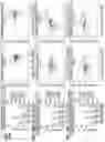 Fig. 163 - CHIMERIC ANTIGEN RECEPTOR T CELL THERAPY