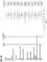 Fig. 184 - CHIMERIC ANTIGEN RECEPTOR T CELL THERAPY