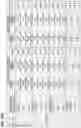Fig. 200 - CHIMERIC ANTIGEN RECEPTOR T CELL THERAPY