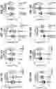 Fig. 24 - CHIMERIC ANTIGEN RECEPTOR T CELL THERAPY