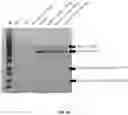 Fig. 03 - COMPOSITIONS AND METHODS FOR TREATMENT OF DISEASES INVOLVING CXCL1 FUNCTION