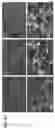 Fig. 06 - METHODS FOR MODULATING INFLAMMASOME ACTIVITY AND INFLAMMATION IN THE LUNG