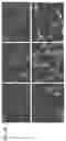 Fig. 07 - METHODS FOR MODULATING INFLAMMASOME ACTIVITY AND INFLAMMATION IN THE LUNG