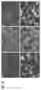 Fig. 08 - METHODS FOR MODULATING INFLAMMASOME ACTIVITY AND INFLAMMATION IN THE LUNG