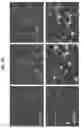 Fig. 10 - METHODS FOR MODULATING INFLAMMASOME ACTIVITY AND INFLAMMATION IN THE LUNG
