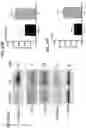 Fig. 21 - METHODS FOR MODULATING INFLAMMASOME ACTIVITY AND INFLAMMATION IN THE LUNG