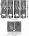 Fig. 10 - Methods of treating an inflammatory disorder by administering an antibody which binds to a connexin CX43 hemichannel