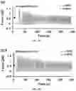 Fig. 13 - A MICRO PHYSIOLOGICAL MODEL FOR NEURONAL AND MUSCULAR DISEASES AND DISORDERS