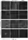 Fig. 19 - RPE CELL POPULATIONS AND METHODS OF GENERATING SAME