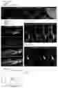 Fig. 12 - Assembly of functionally integrated human forebrain spheroids and methods of use thereof