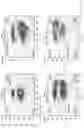 Fig. 16 - IMPROVED PROCESS FOR DNA INTEGRATION USING RNA-GUIDED ENDONUCLEASES