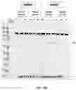 Fig. 29 - COMPOSITIONS AND METHODS TO MANUFACTURE TUMOR SUPPRESSOR FUSIONS