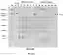 Fig. 32 - COMPOSITIONS AND METHODS TO MANUFACTURE TUMOR SUPPRESSOR FUSIONS
