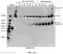 Fig. 33 - COMPOSITIONS AND METHODS TO MANUFACTURE TUMOR SUPPRESSOR FUSIONS