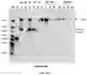 Fig. 35 - COMPOSITIONS AND METHODS TO MANUFACTURE TUMOR SUPPRESSOR FUSIONS