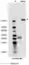 Fig. 36 - COMPOSITIONS AND METHODS TO MANUFACTURE TUMOR SUPPRESSOR FUSIONS