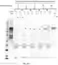 Fig. 50 - COMPOSITIONS AND METHODS TO MANUFACTURE TUMOR SUPPRESSOR FUSIONS
