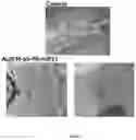 Fig. 22 - NANOSYSTEM BASED ON MICRORNA FOR TREATING OBSESITY
