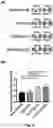 Fig. 03 - AUGMENTATIONS TO LENTIVIRAL VECTORS (CCLC-MGATA/ANK-CORE LCR-BETA-AS3-FB) TO INCREASE EXPRESSION
