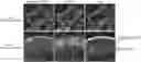 Fig. 01 - Method for Evaluating Quality of Transplant Neural Retina, and Transplant Neural Retina Sheet