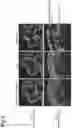 Fig. 03 - Method for Evaluating Quality of Transplant Neural Retina, and Transplant Neural Retina Sheet