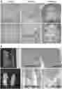 Fig. 01 - Methods of identifying and treating a person having a predisposition to or afflicted with a cardiometabolic disease