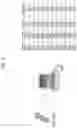 Fig. 02 - METHOD FOR IDENTIFYING DISEASE-ASSOCIATED CDR3 PATTERNS IN AN IMMUNE REPERTOIRE