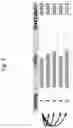 Fig. 04 - METHOD FOR IDENTIFYING DISEASE-ASSOCIATED CDR3 PATTERNS IN AN IMMUNE REPERTOIRE