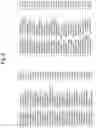 Fig. 06 - METHOD FOR IDENTIFYING DISEASE-ASSOCIATED CDR3 PATTERNS IN AN IMMUNE REPERTOIRE