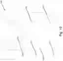Fig. 10 - Foundation pier bracket system
