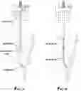 Fig. 02 - Active magnetic ranging while drilling