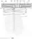 Fig. 02 - Downhole transmission system with perforated MCEI segments