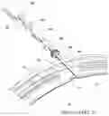 Fig. 14 - Downhole transmission system with perforated MCEI segments