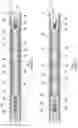 Fig. 02 - Packer assembly for deforming wellbore casing