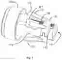 Fig. 02 - Device for fixing equipment to an end of the inner surface of a tube